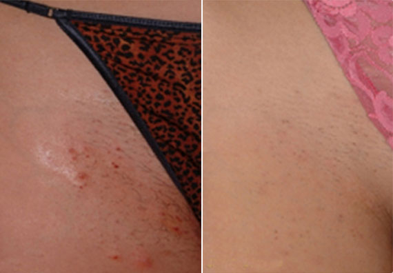 Skin Improvements